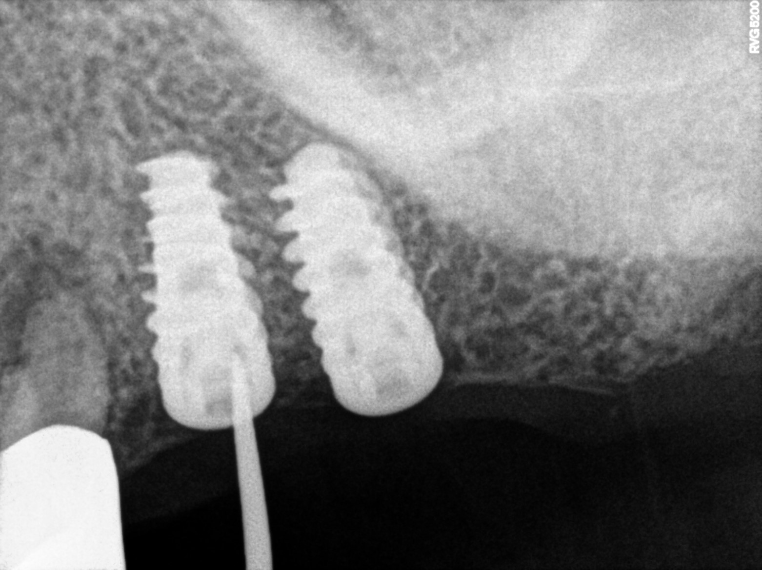 Dental X-ray